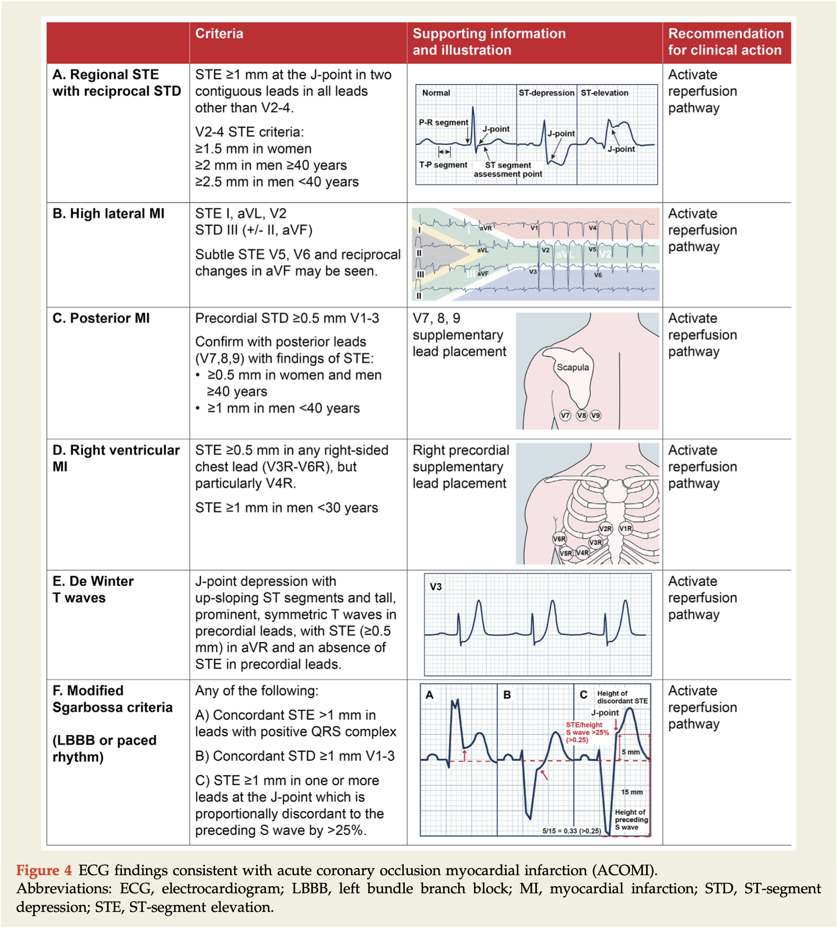 STEMI Equivalents